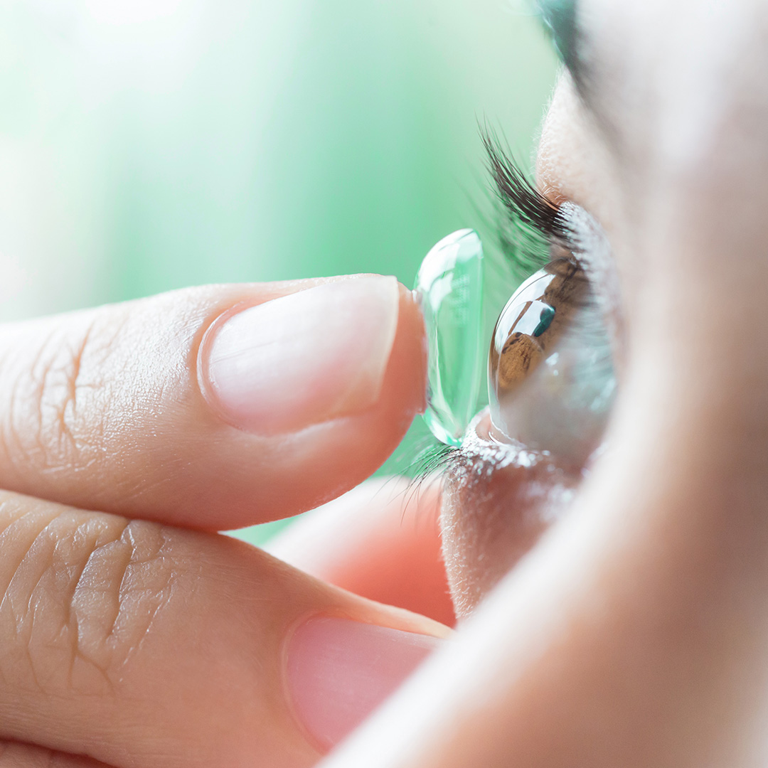Close-up of a person inserting a disposable contact lens, illustrating Syntegon's case study on sterilizing over 60% of the world's contact lenses with 99.9% equipment availability.